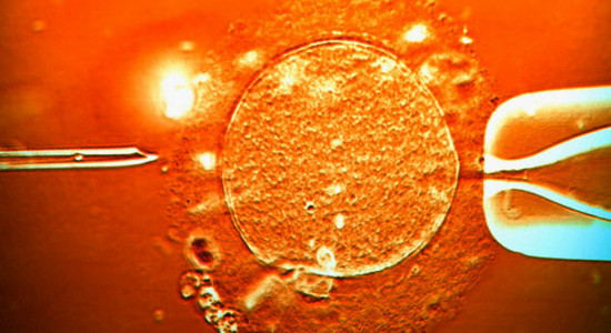 La  recente sentenza della Corte di Strasburgo,  che boccia la legge 40/2009 per quanto riguarda gli  articoli  4 e 13, relativi al divieto di diagnosi pre-impianto e alla impossibilità di […]